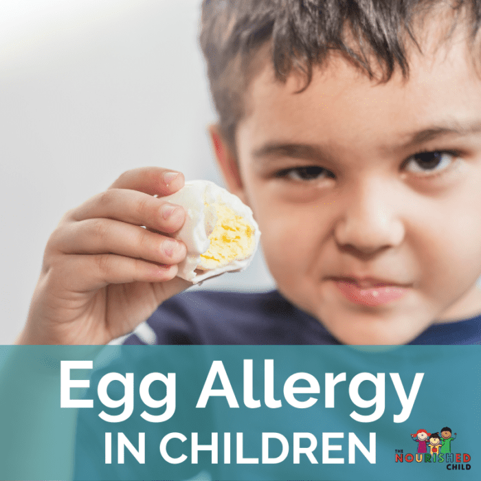 Egg Allergy in Children